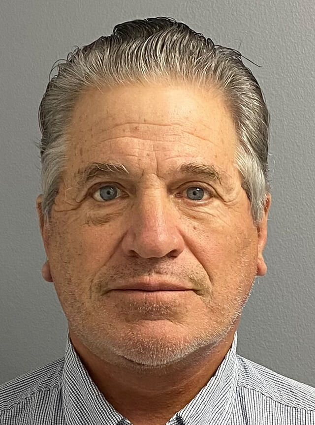 Case--6178 | After Facelift and Neck Lift